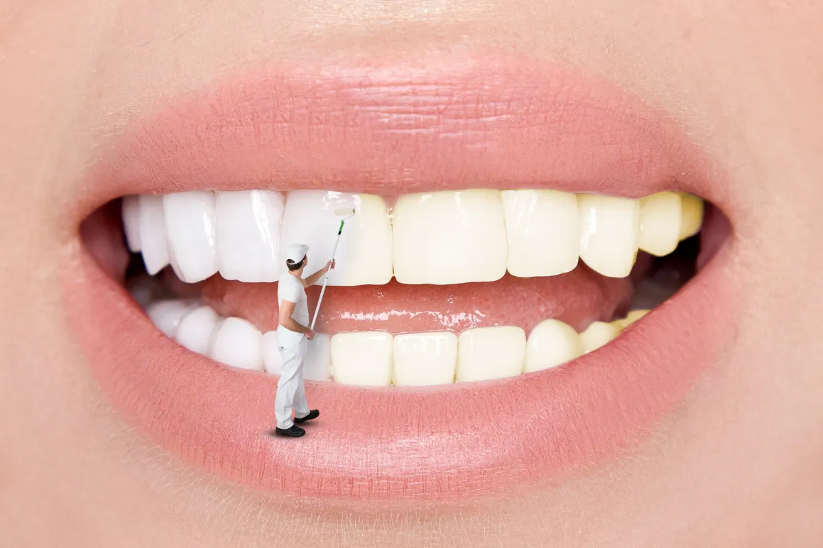 Natural Teeth Whitening